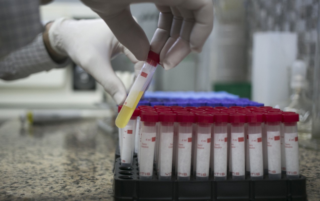 Red Laboratorio. Dr Lucas Bau
